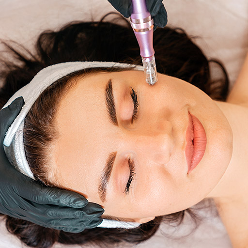 Micro Needling